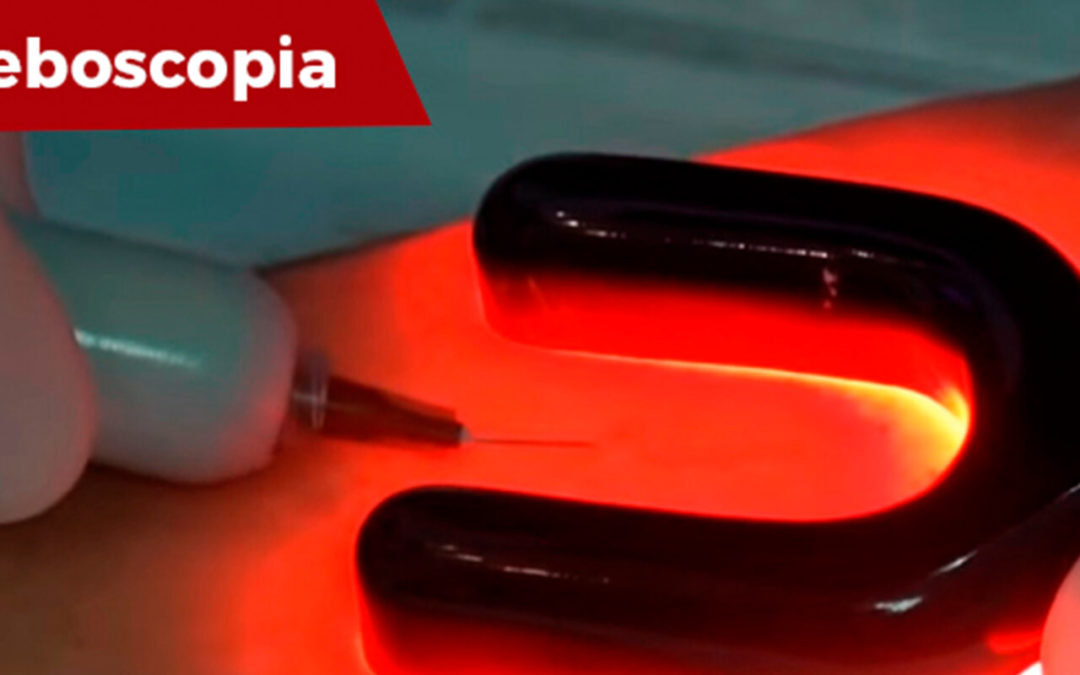 Novo exame na Clínica: Fleboscopia