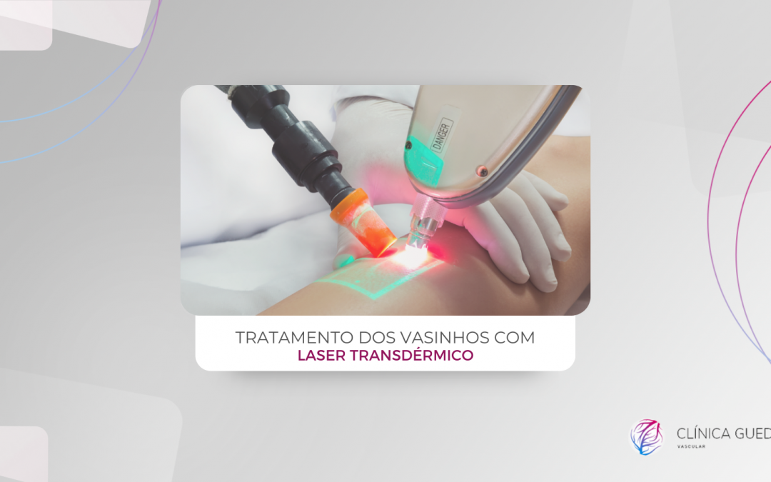 Tratamento dos vasinhos com Laser Transdérmico